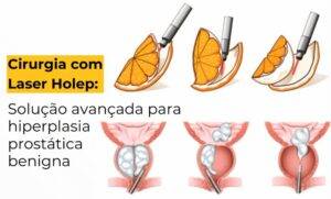 Holep prostata